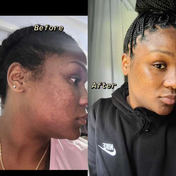Skincare Consultation (15min)  TheFlowerPotLLC   